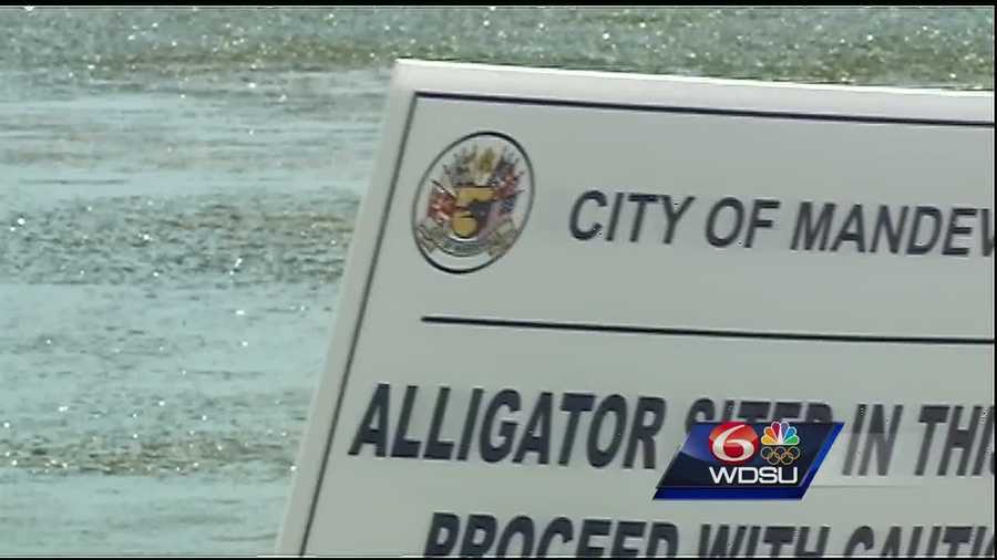 After an alligator attacked a boy in Orlando this week, the city of Mandeville said it wants residents to be careful along the lakefront.
