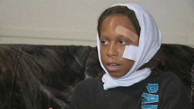 Doctors have found new bite wounds on a 10-year-old boy attacked by a pit bull over the weekend in Cocoa.