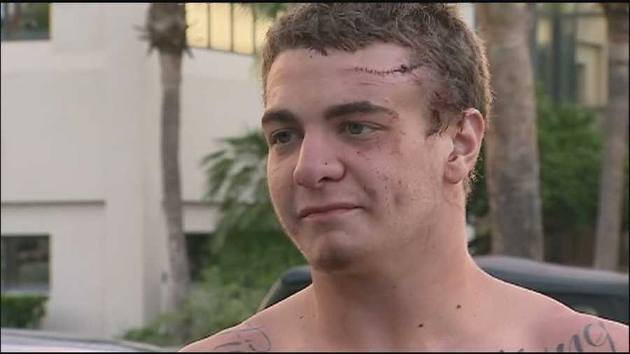 A teen who was bitten in the head by an alligator is recovering and in good spirits.
