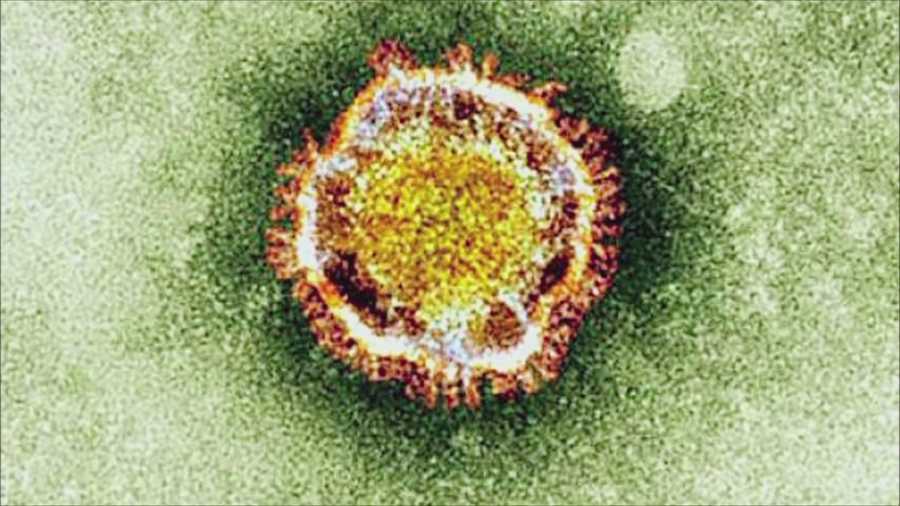 Health officials say MERS is very serious but spreads exactly like a cold.