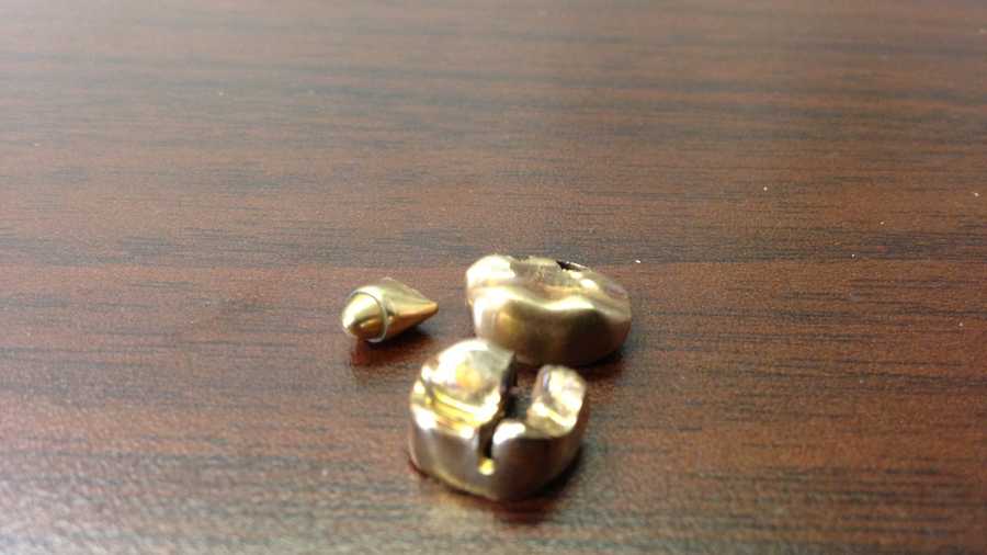 See some of the interesting items donated at Salvation Army kettles in Orlando, including these gold teeth caps.