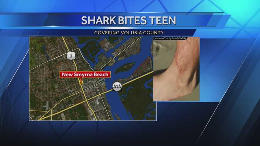 A teen surfer is recovering after becoming Volusia County's latest shark bite victim.