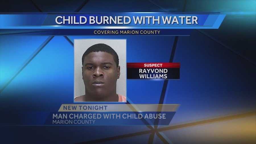 A man is accused of leaving a 2-year-old in scalding hot water after he wet the bed, causing serious burns and his skin to peel off, according to the Marion County Sheriff's Office. Summer Knowles (@WESH2SummerK) has the story.