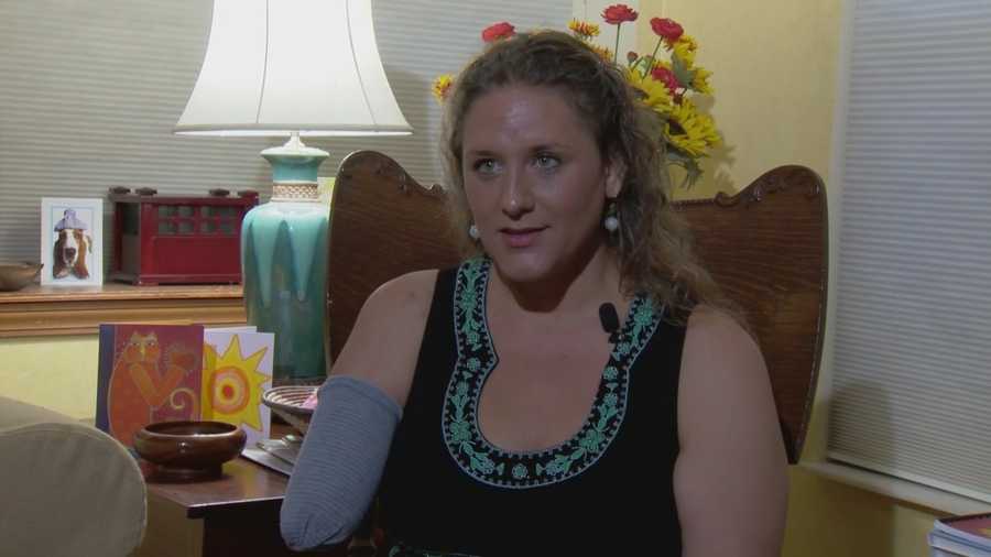 The Rollins College professor who lost her right arm in an alligator attack is telling her story to WESH 2 News. Amanda Ober (@AmandOberWESH) has the story.
