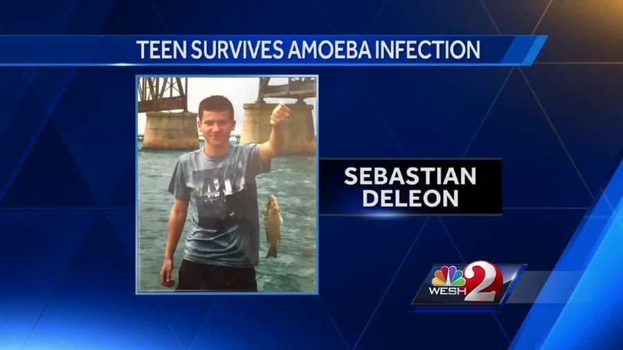 Sebastian DeLeon, 16, contracted a brain-eating amoeba in Broward County. The infection kills most people, but DeLeon is now one of four survivors in the United States in the past 50 years. Amanda Crawford reports.