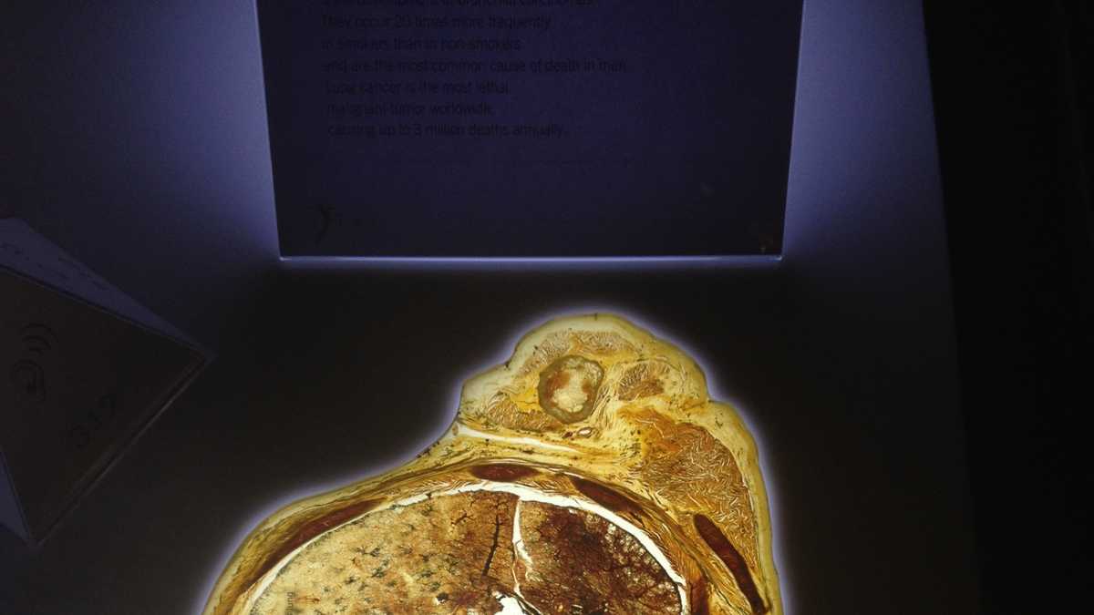 Images Body Worlds Exhibit Opens at Kentucky Science Center