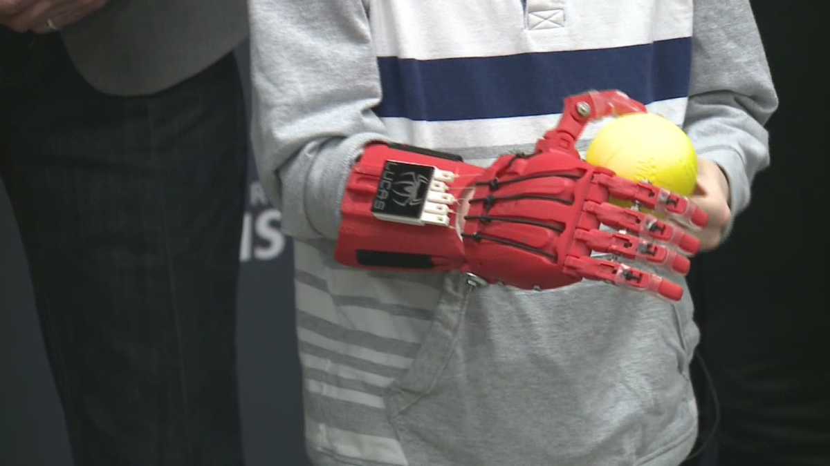 UofL students create bionic hand for 6-year-old