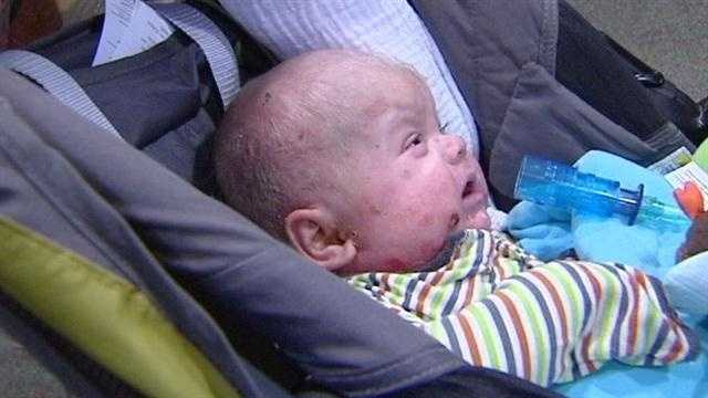 Help Save Easton- baby battling Epidermolysis Bullosa- EB