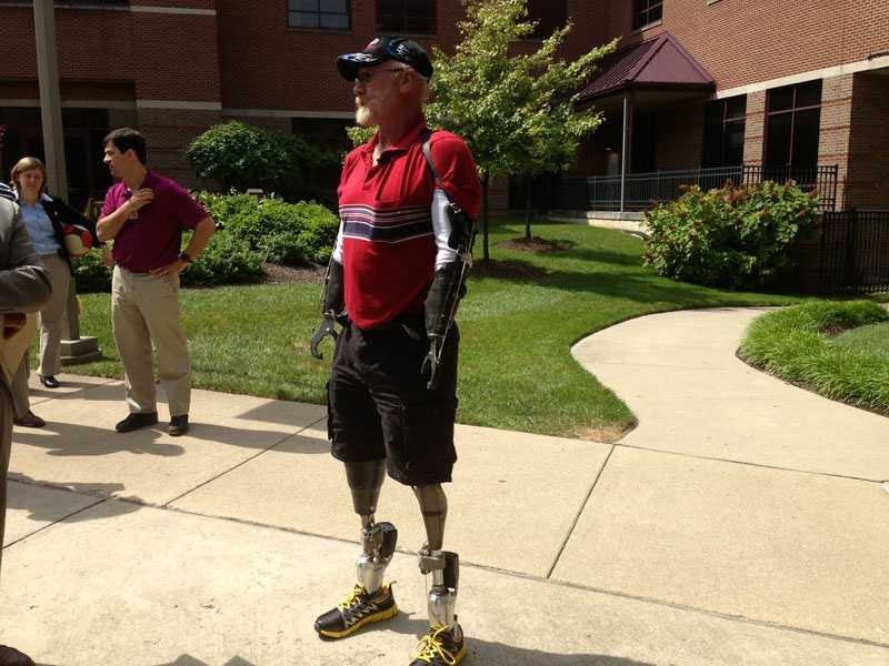 Photos: Quad amputee tries out new robotic legs at Drake