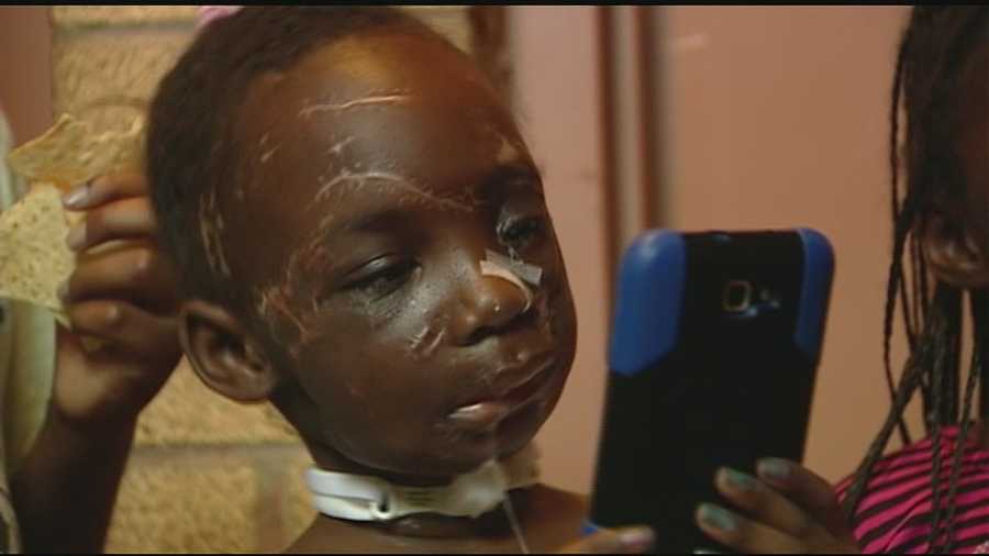 Two months and one day after 6-year-old Zainabou Drame was mauled by two pit bulls, she left Cincinnati Children's Hospital.