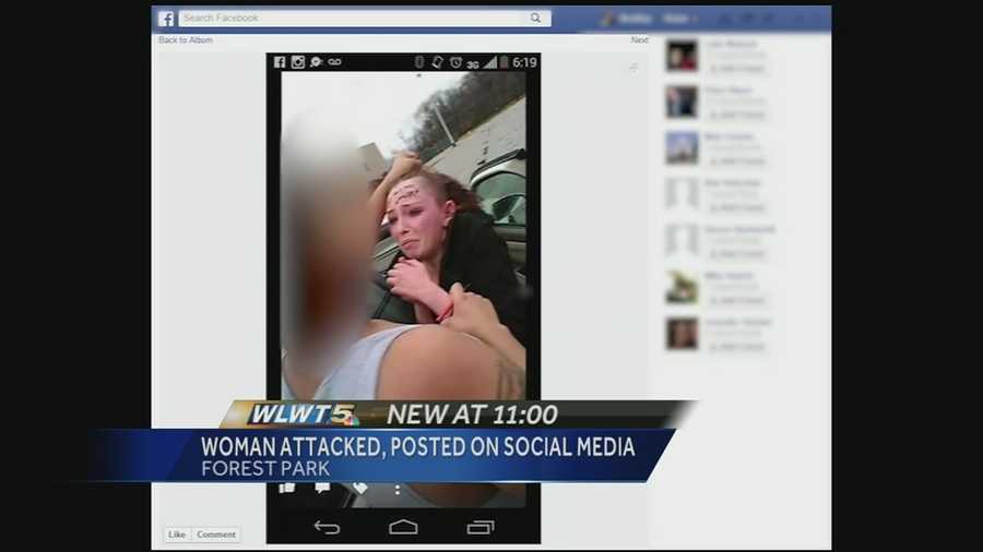 A Colerain Township woman says she was attacked, her head was shaved and her forehead was written on. Photos of the attack were then posted to Facebook.