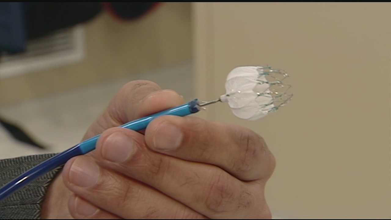 Watchman Device Offers Option To Patients With Irregular Heart Beats