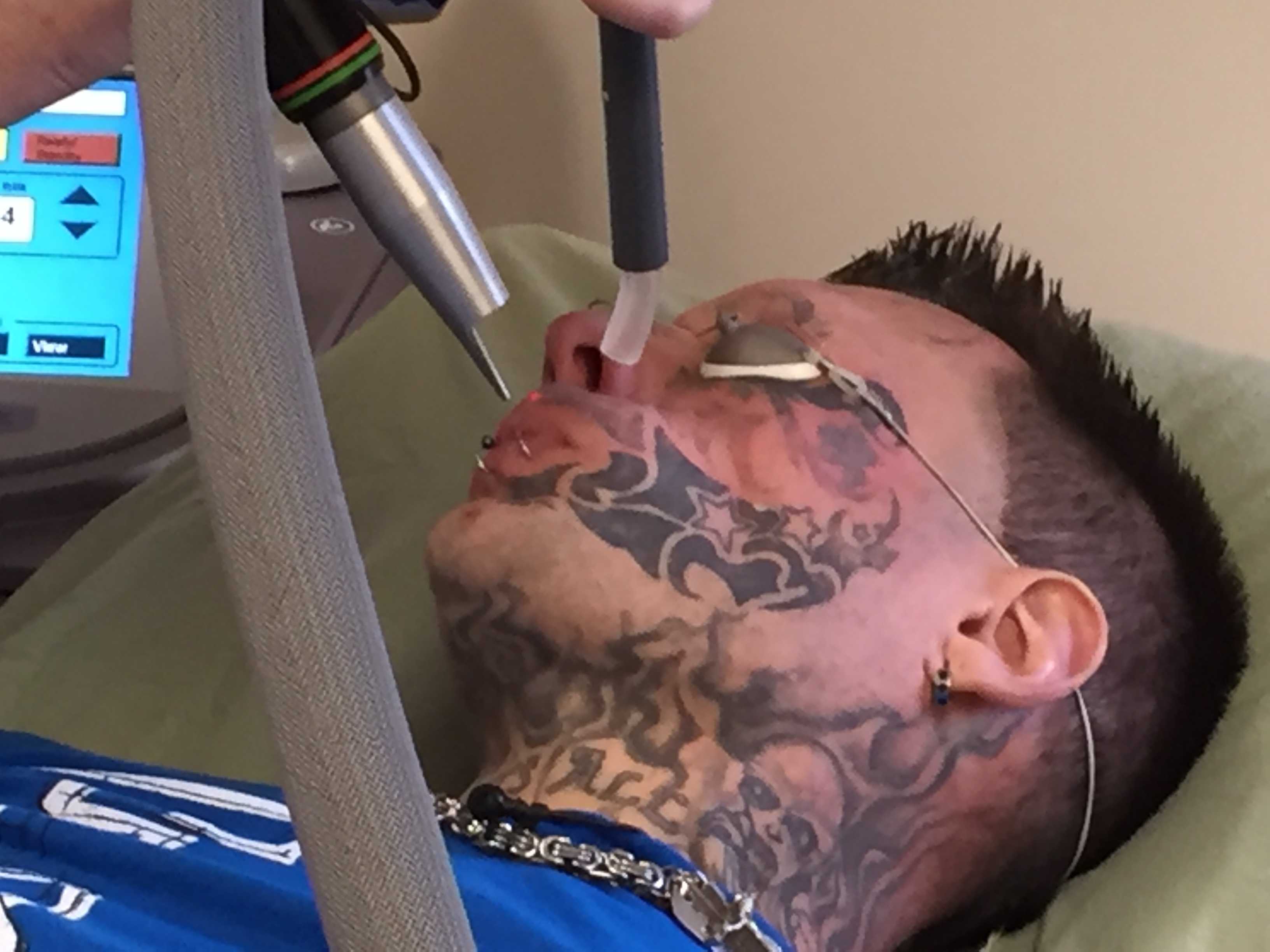 World's Fastest Tattoo Removal. Removing tattoos in weeks!
