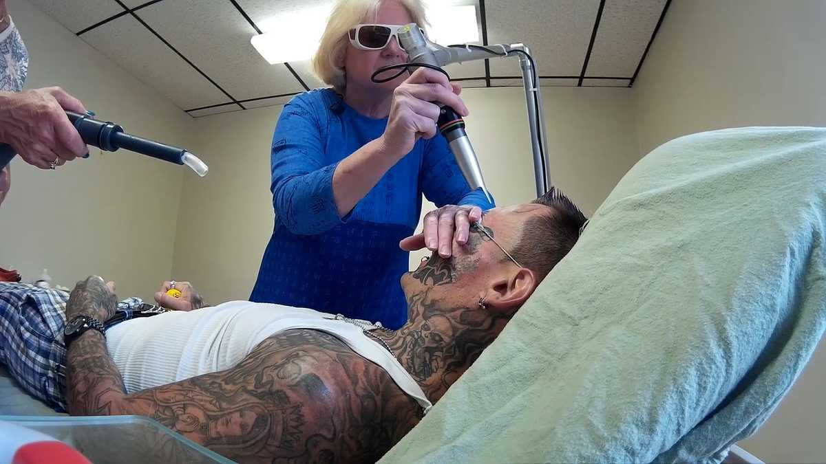Images Maine Man Undergoes Procedure To Remove Face Tattoos