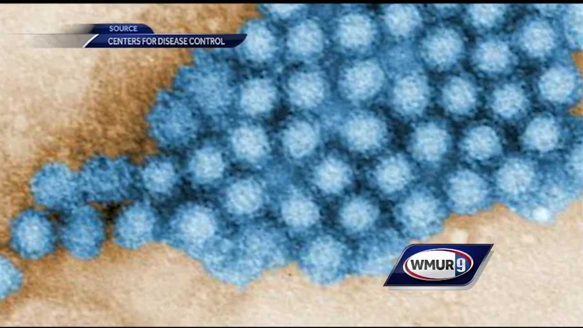 School in Concord closes because of norovirus outbreak