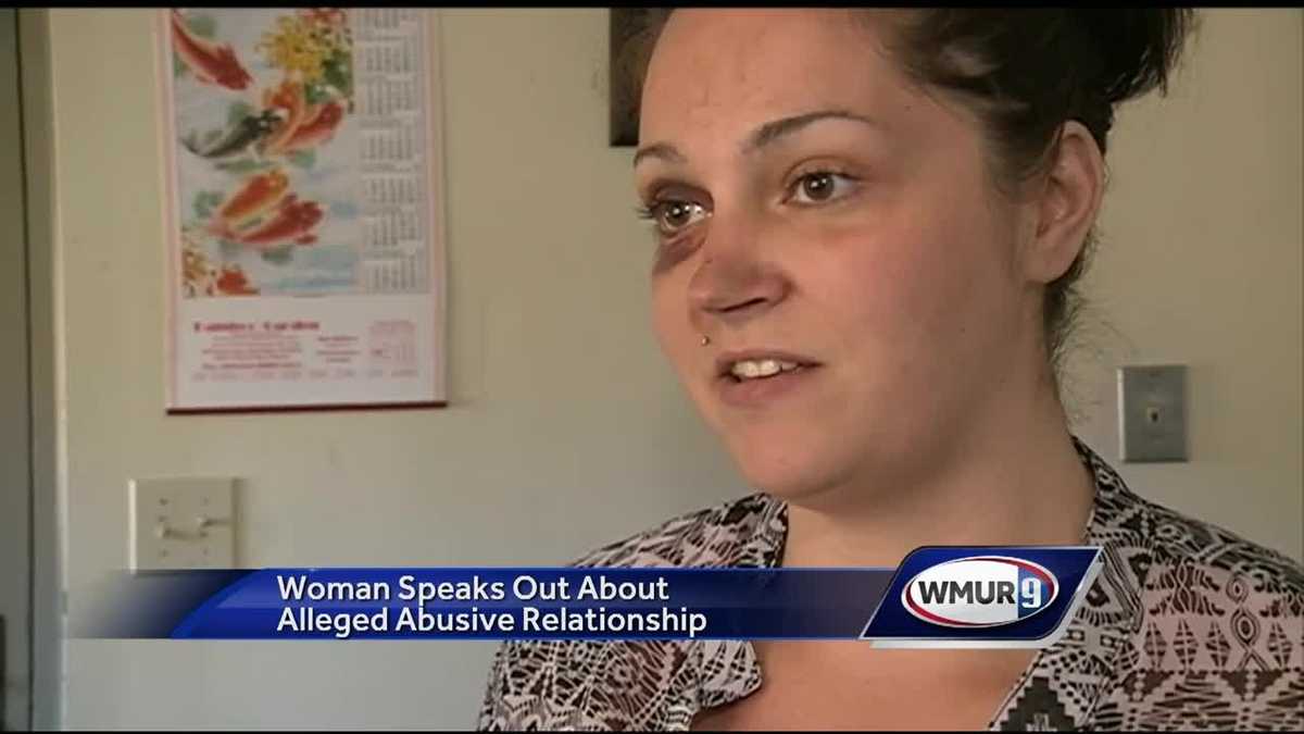 Woman Who Says Boyfriend Assaulted Her Hopes Her Story Helps Others 6765