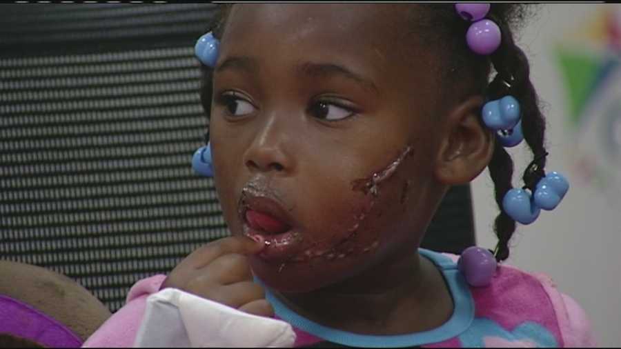 A 3-year-old girl is recovering at a hospital after she was bitten by a pit bull. The dog's owner says he doesn't want to get rid of his best friend, even though the girl's family is calling for him to do so.