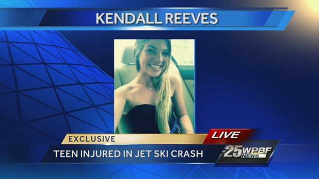 Kendall Reeves, 17, is fighting for her life at St. Mary's Medical Center after she and a friend were riding separate jet skis that collided on the Loxahatchee River near Jupiter Sand Dune this week.