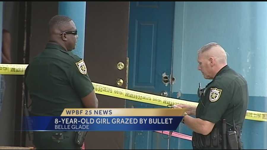 The Palm Beach Sheriff's Office is investigating a shooting involving a child who was grazed by a bullet Sunday.