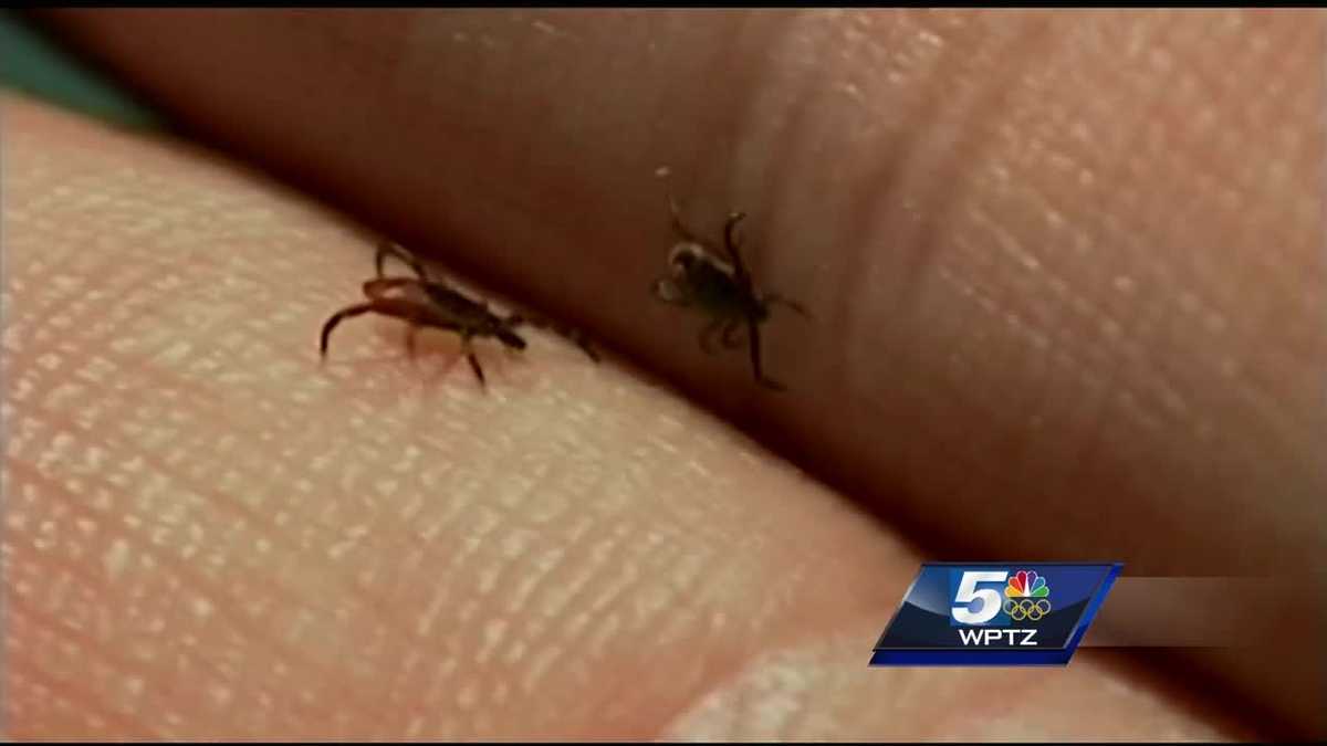 Tick bites increasing in Vermont