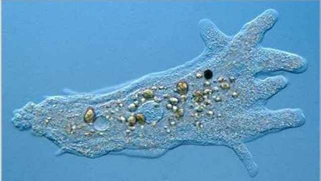 CDC confirms SC patient with 'brain-eating' amoeba