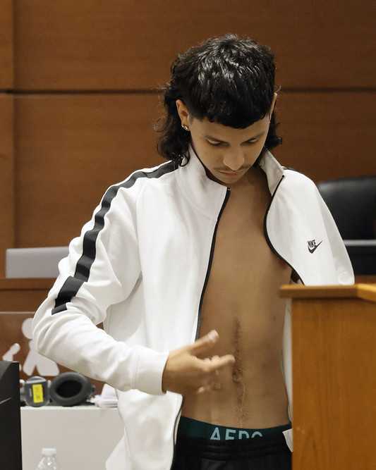 Former Marjory Stoneman Douglas High School student Anthony Borges shows his gunshot wounds to the jury. He was shot five times. Marjory Stoneman Douglas High School shooter Nikolas Cruz is being tried in the penalty phase of his trial at the Broward County Courthouse in Fort Lauderdale on Wednesday, July 20, 2022. Cruz previously plead guilty to all 17 counts of premeditated murder and 17 counts of attempted murder in the 2018 shootings. (Mike Stocker/South Florida Sun Sentinel via AP, Pool)