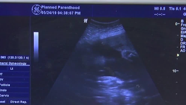 Abortion initiative arguments to hit Florida Supreme Court - Vimarsana News