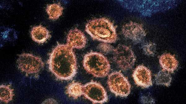 FILE - This 2020 electron microscope image provided by the National Institute of Allergy and Infectious Diseases — Rocky Mountain Laboratories — shows SARS-CoV-2 virus particles, which cause COVID-19, isolated from a patient in the U.S., emerging from the surface of cells cultured in a lab.