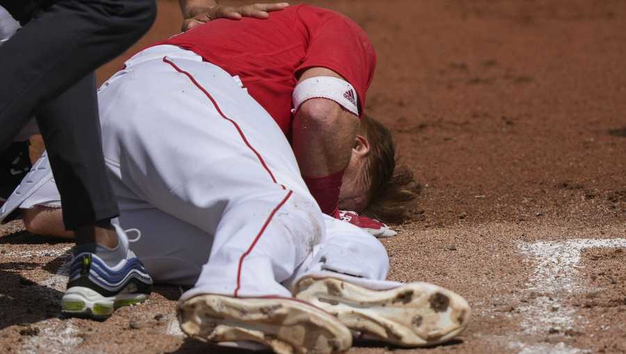 Boston Red Sox Justin Turner rolls on the ground after being hit in the face on a pitch by Detroit Tigers starting pitcher Matt Manning in the first inning of their spring training baseball game in Fort Myers, Fla., Monday, March 6, 2023. (AP Photo/Gerald Herbert)