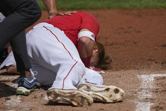 Justin Turner Injury Video, Red Sox's Justin Turner Hospitalized After  Being Hit in the Face byPitch in 2023
