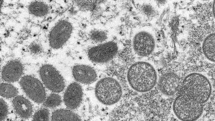 This 2003 electron microscope image made available by the Centers for Disease Control and Prevention shows mature, oval-shaped monkeypox virions, left, and spherical immature virions, right, obtained from a sample of human skin associated with the 2003 prairie dog outbreak. Monkeypox, a disease that rarely appears outside Africa, has been identified by European and American health authorities in recent days. (Cynthia S. Goldsmith, Russell Regner/CDC via AP)