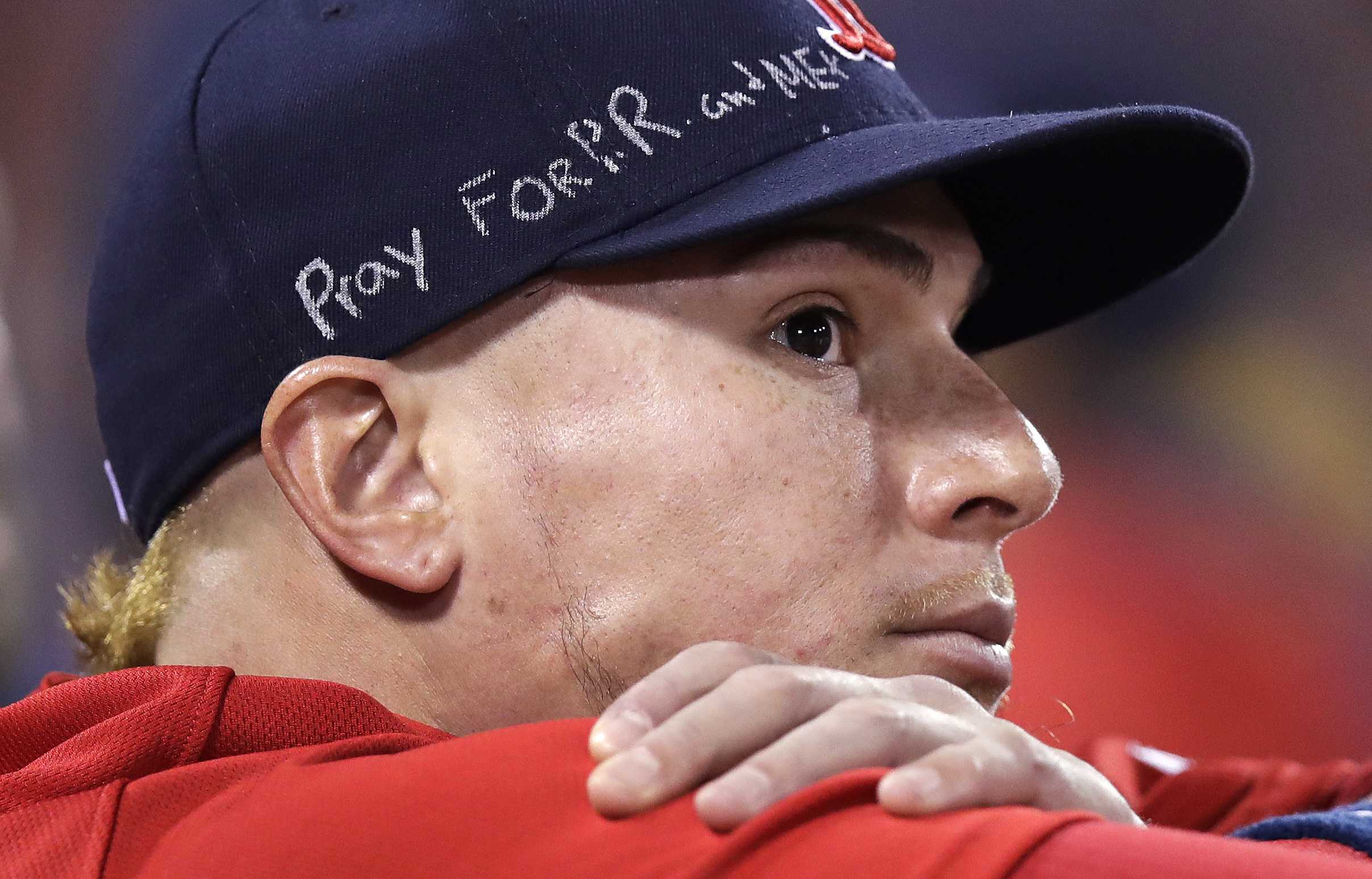 Christian Vazquez to have surgery on fractured pinky