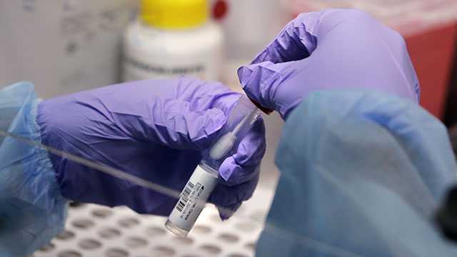 Contact tracing revs up in some states as omicron coronavirus variant reaches US - Vimarsana News