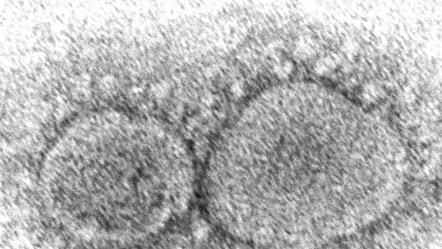 Vaccine makers are racing to update their COVID-19 shots, just in case - Vimarsana News