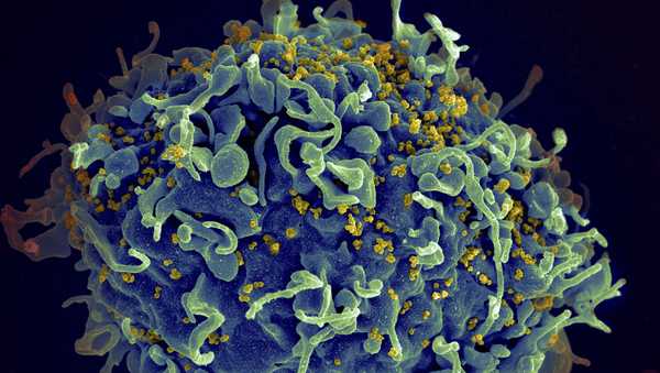 FILE - This colorized electron microscope image made available by the U.S. National Institutes of Health shows a human T cell, indicated in blue, under attack by HIV, in yellow, the virus that causes AIDS. In a study released in the journal Nature on Thursday, April 28, 2022, climate change will result in thousands of new viruses spread among animal species by 2070, which is likely to increase the risk of emerging infectious diseases jumping from animals to humans. (Seth Pincus, Elizabeth Fischer, Austin Athman/National Institute of Allergy and Infectious Diseases/NIH via AP)