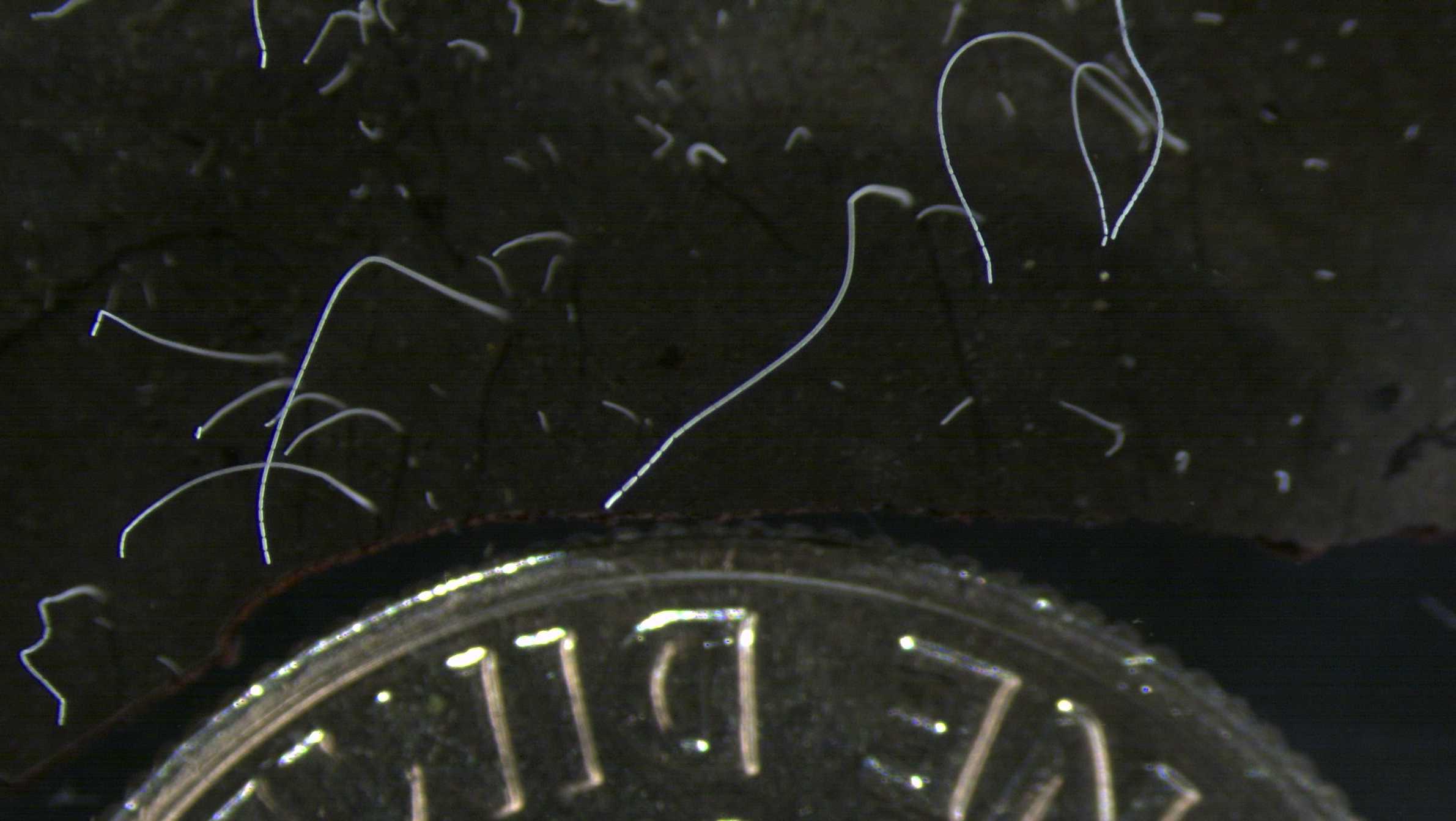 World's biggest bacterium found in Caribbean can be seen with naked eye - Vimarsana News