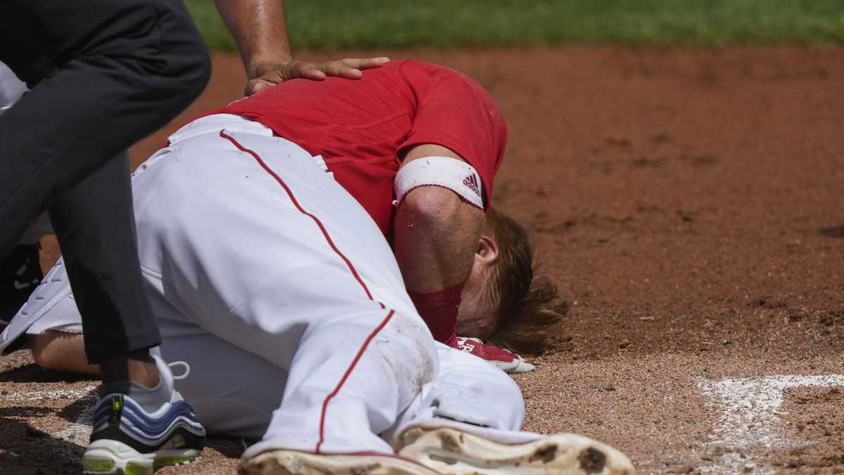 Turner taken to hospital after pitch struck his face during Red