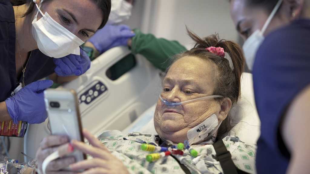 Woman is back on dialysis after doctors remove transplanted pig kidney - Vimarsana News
