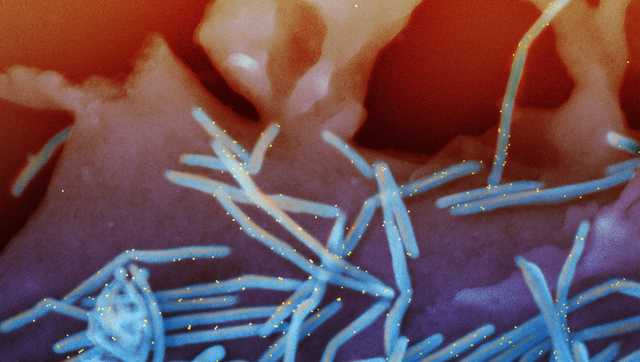 FDA approves 1st vaccine for RSV after decades of attempts - Vimarsana News