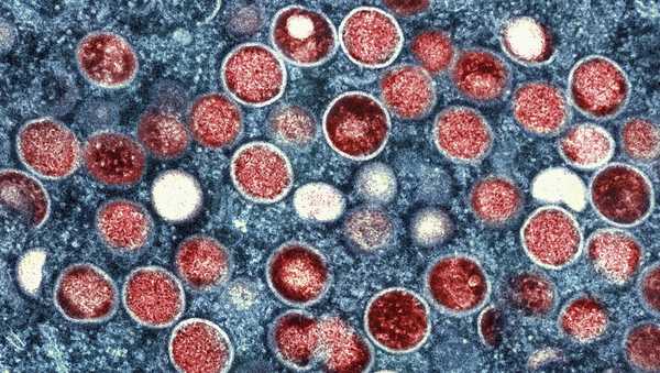 This colorized electron microscope image provided by the National Institute of Allergy and Infectious Diseases shows mpox particles, red, found within an infected cell, blue, cultured in a laboratory in Fort Detrick, Md. A study released by the U.S. Centers for Disease Control and Prevention on Thursday, May 25, 2023, suggests dozens of U.S. cities are at risk for mpox outbreaks this summer. Health officials say they are working to prevent the scale of infections that surprised the nation the previous summer. (NIAID via AP, File)