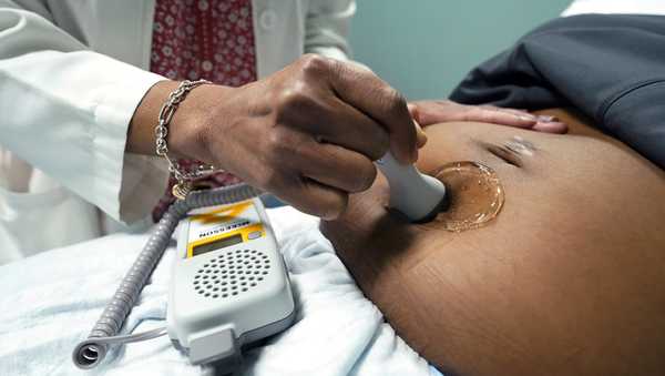 FILE - A doctor uses a hand-held Doppler probe on a pregnant woman to measure the heartbeat of the fetus on Dec. 17, 2021, in Jackson, Miss. U.S. births were flat in 2022, as the nation continues to see fewer babies born than before the pandemic. (AP Photo/Rogelio V. Solis, File)