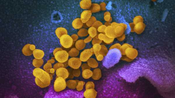 FILE - This undated, colorized electron microscope image made available by the U.S. National Institutes of Health in February 2020 shows the Novel Coronavirus SARS-CoV-2, indicated in yellow, emerging from the surface of cells, indicated in blue/pink, cultured in a laboratory. The National Institutes of Health is opening a handful of studies to start testing possible treatments for long COVID, an anxiously awaited step in U.S. efforts against the mysterious condition. The announcement, Monday, July 31, 2023 comes amid frustration from patients who've struggled for months or years with sometimes disabling health problems. (NIAID-RML via AP, File)
