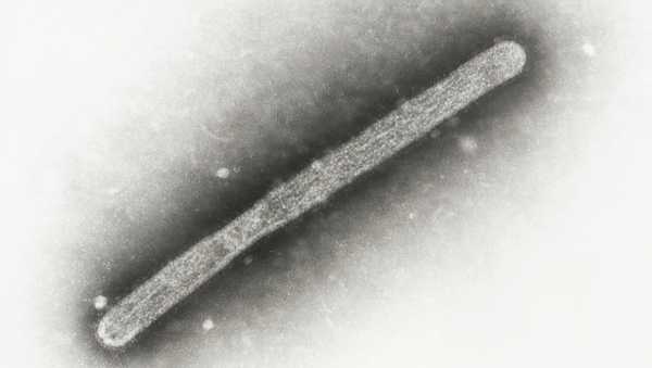 This 2005 electron microscope image shows an avian influenza A H5N1 virion. On Wednesday, May 22, 2024, Michigan health officials said a farmworker has been diagnosed with bird flu, the second human case connected to an outbreak in U.S. dairy cows. (Cynthia Goldsmith, Jackie Katz/CDC via AP)