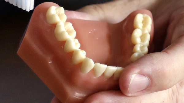 FILE - A dentist holds a model of teeth in Seattle. (AP Photo/Elaine Thompson, File)