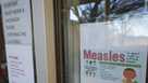 Measles sign in Texas