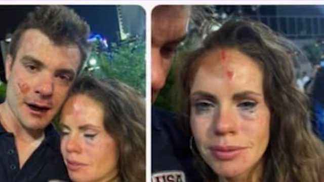 Photos show cuts couple sustained during assault at The Banks - Vimarsana News