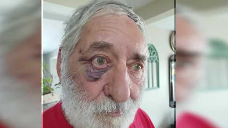 20-year-old charged for allegedly attacking 78-year-old man with dementia, police say - Vimarsana News