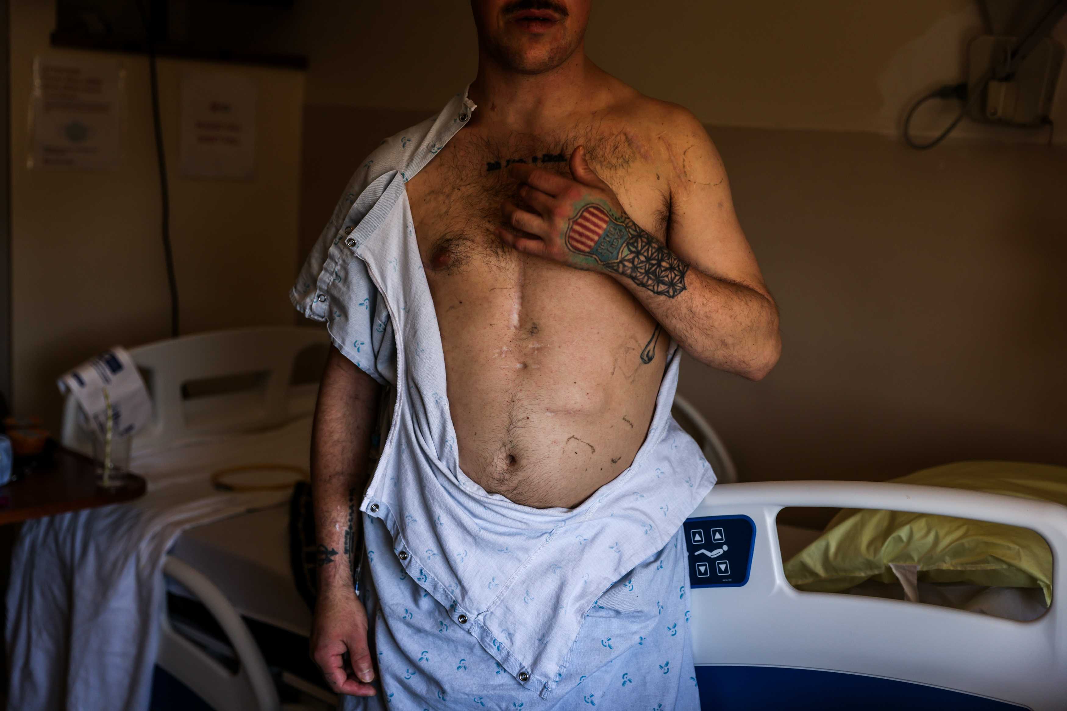 San Francisco Chronicle: This dangerous heart infection is associated with drug use