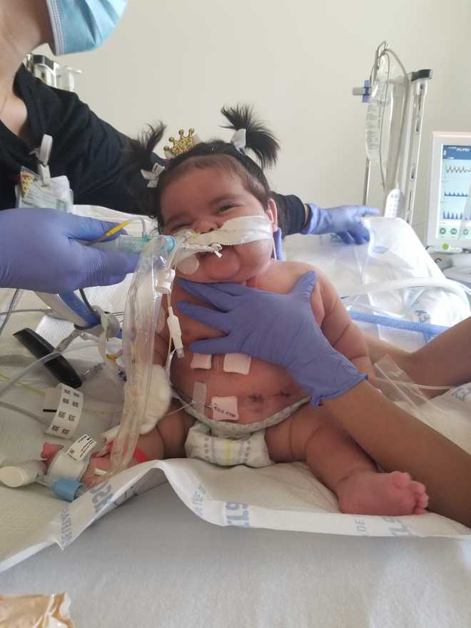 Sacramento newborn survives rare heart transplant