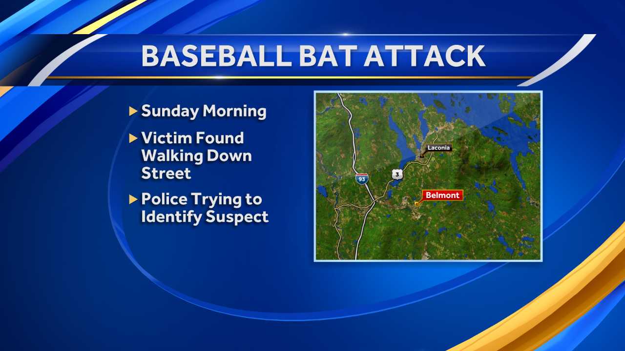 Police Looking For Man Who Attacked Victim With Bat